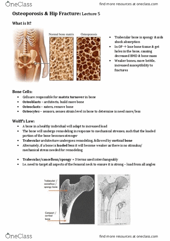 EXSS3027 Lecture Notes - Lecture 5: Osteopenia, Vertebral Compression Fracture, Bone Resorption thumbnail