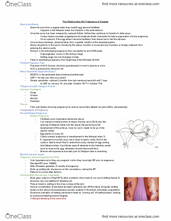 MEDRADSC 1B03 Lecture Notes - Lecture 25: Ectopic Pregnancy, Fallopian Tube, Chorionic Villi thumbnail