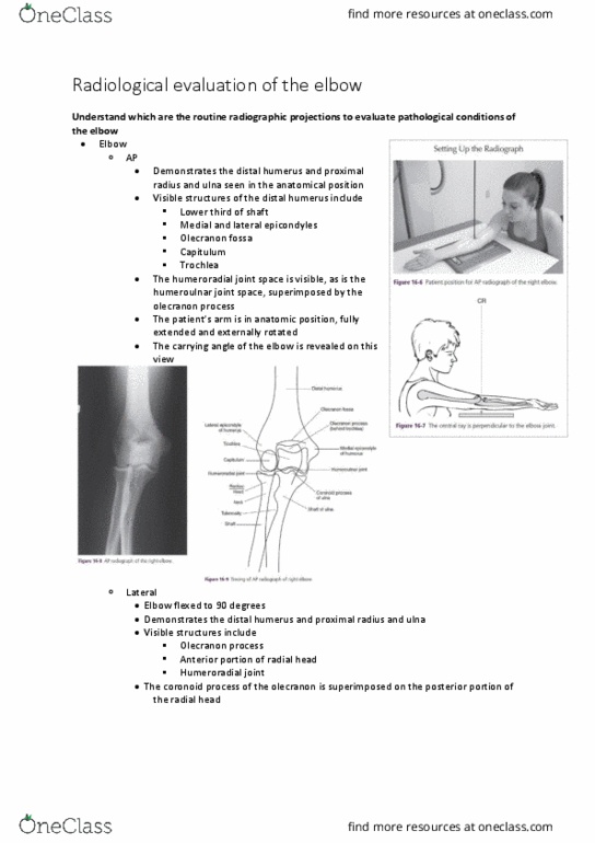 PHTY207 Lecture Notes - Lecture 15: Olecranon Fossa, Head Of Radius, Olecranon thumbnail