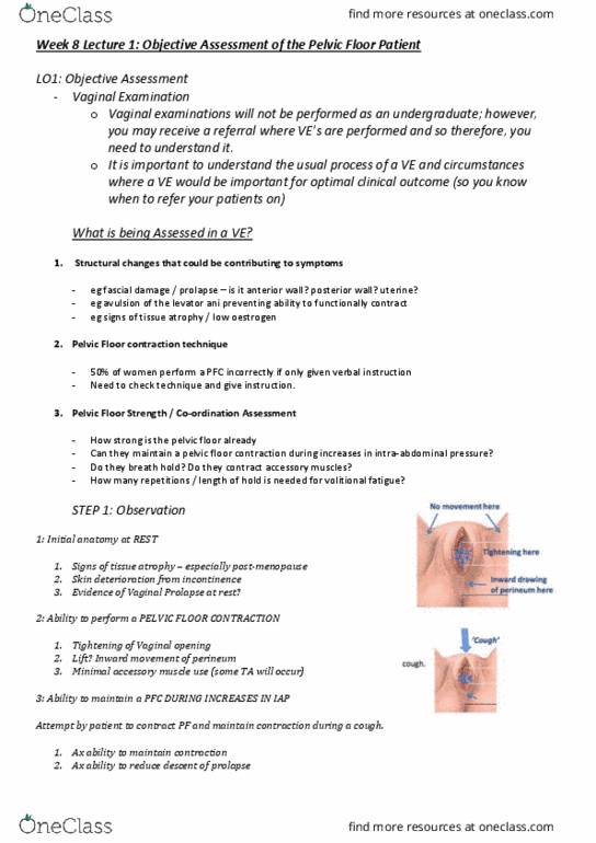 PHTY306 Lecture Notes - Lecture 8: Pelvic Floor, Nocturia, Stress Incontinence thumbnail