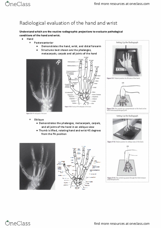 PHTY207 Lecture Notes - Lecture 20: Carpometacarpal Joint, Scaphoid Fracture, Metacarpal Bones thumbnail