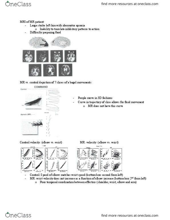 Kinesiology 1080A/B Lecture Notes - Lecture 16: Electroencephalography, Functional Magnetic Resonance Imaging, Triceps Brachii Muscle thumbnail