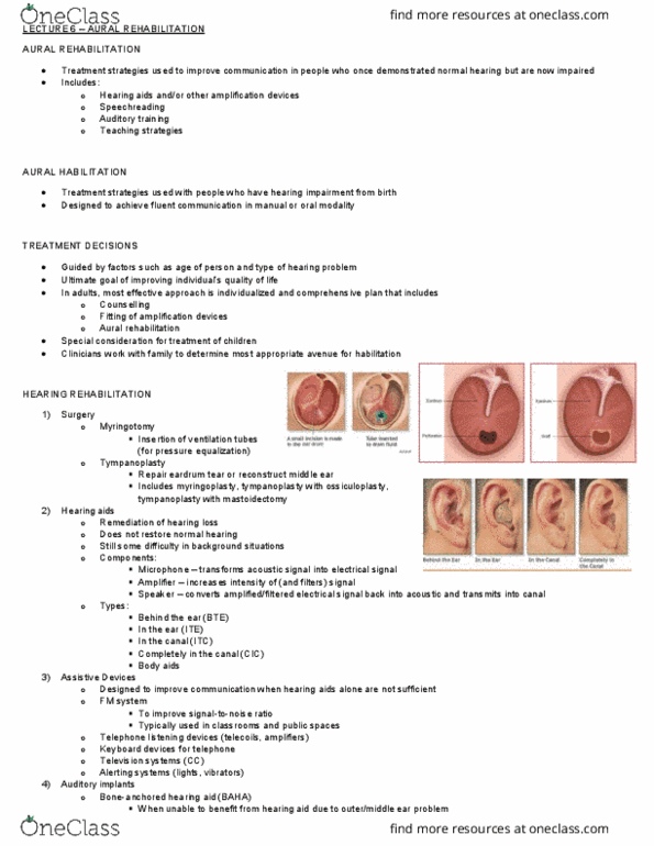 Communication Sciences and Disorders 4411A/B Lecture Notes - Lecture 6: Tympanoplasty, Mastoidectomy, Habilitation thumbnail