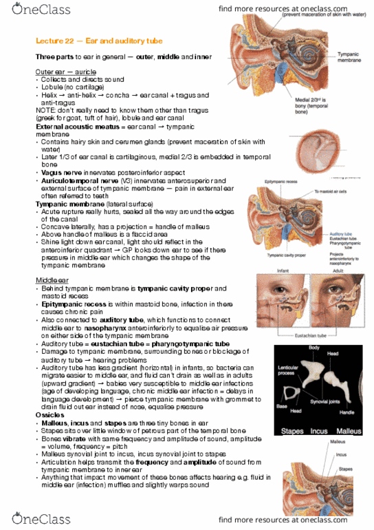 ANAT30008 Lecture Notes - Lecture 22: Otitis Media, Ear Canal, Epitympanic Recess thumbnail