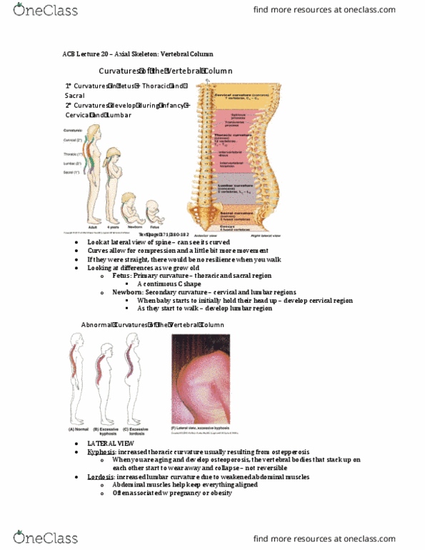 Anatomy and Cell Biology 3319 Lecture Notes - Lecture 20: Kyphosis, Osteoporosis, Hyaline Cartilage thumbnail