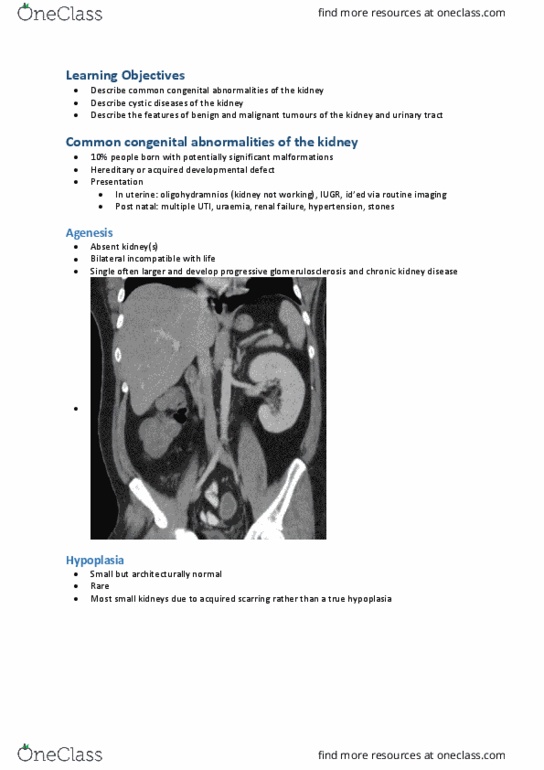 CAM202 Lecture Notes - Lecture 15: Uremia, Glomerulosclerosis, Hypoplasia thumbnail