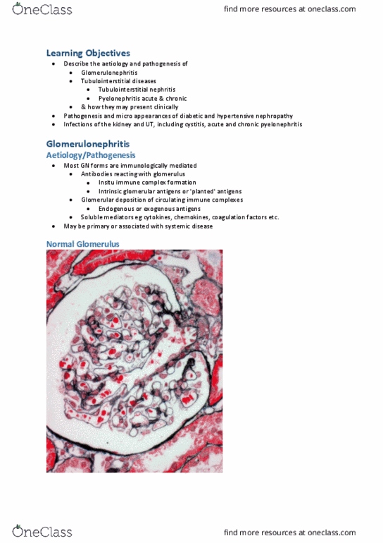 CAM202 Lecture Notes - Lecture 7: Pyelonephritis, Hypertensive Kidney Disease, Immune Complex thumbnail