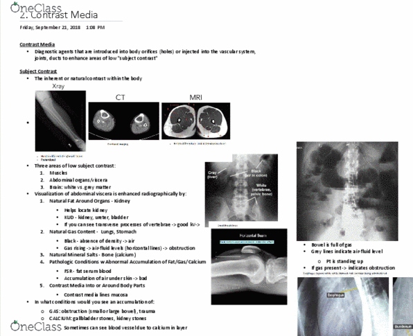 MEDRADSC 2I03 Lecture Notes - Lecture 2: Kidney Stone Disease, Grey Matter, Vertebra thumbnail