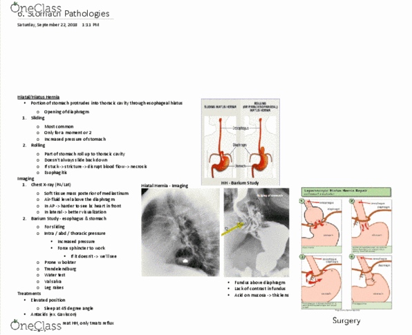 MEDRADSC 2I03 Lecture Notes - Lecture 6: Esophageal Hiatus, Thoracic Cavity, Antacid thumbnail