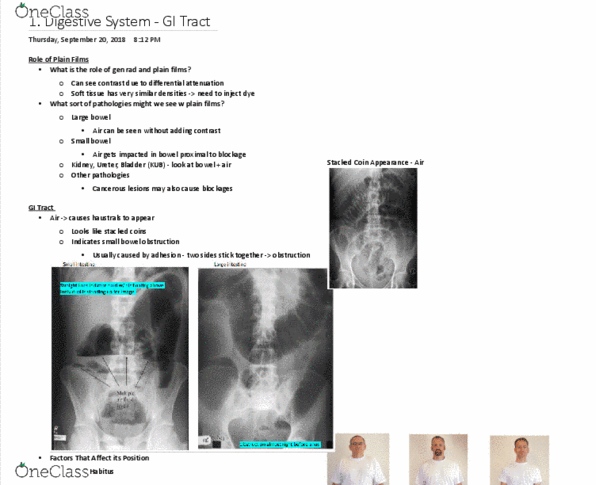 MEDRADSC 2I03 Lecture Notes - Lecture 1: Bowel Obstruction, Abdominal X-Ray, Soft Tissue thumbnail