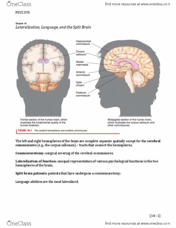 PSYC 370 Chapter Notes -Motor System, Frontal Lobe, Global Aphasia thumbnail