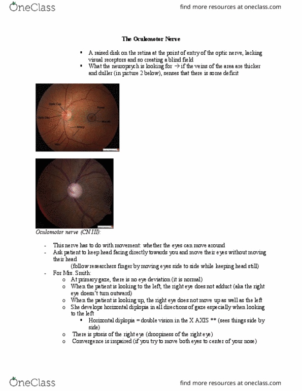 PSYCH 2NF3 Lecture Notes - Lecture 10: Oculomotor Nerve, Diplopia, Retina thumbnail
