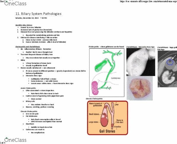 MEDRADSC 2I03 Lecture Notes - Lecture 11: Biliary Colic, Common Bile Duct, Biliary Tract thumbnail
