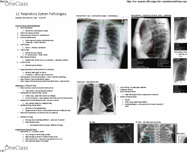 MEDRADSC 2I03 Lecture 12: Respiratory Pathologies thumbnail