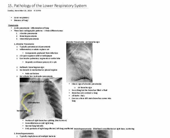 MEDRADSC 2I03 Lecture 15: Pathologies of the Lower Respiratory Tract thumbnail
