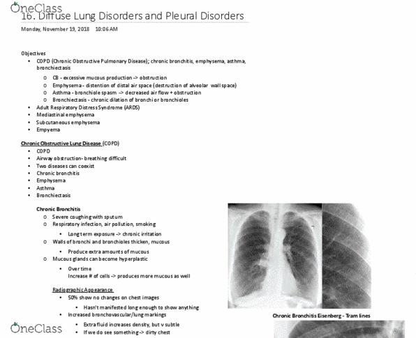 MEDRADSC 2I03 Lecture Notes - Lecture 16: Subcutaneous Emphysema, Chronic Obstructive Pulmonary Disease, Airway Obstruction thumbnail