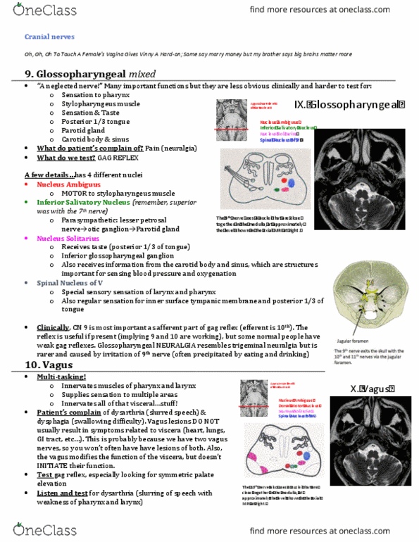 INDS 212 Lecture Notes - Lecture 7: Trigeminal Neuralgia, Stylopharyngeus Muscle, Cranial Nerves thumbnail