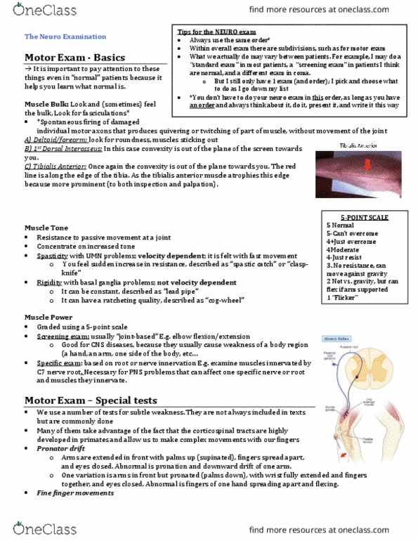 INDS 212 Lecture Notes - Lecture 11: Tibialis Anterior Muscle, Basal Ganglia, Spasticity thumbnail