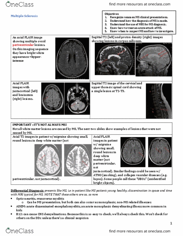 INDS 212 Lecture Notes - Lecture 62: Acute Disseminated Encephalomyelitis, Optic Neuritis, Demyelinating Disease thumbnail