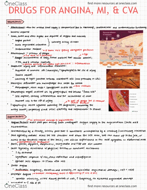HTHSCI 2H03 Lecture Notes - Lecture 16: Myocardial Infarction, Unstable Angina, Angina Pectoris thumbnail
