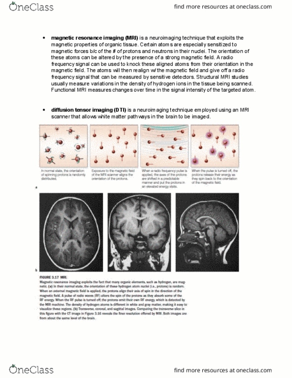 PSYB55H3 Chapter Notes - Chapter 3.8: Diffusion Mri, Functional Magnetic Resonance Imaging, White Matter thumbnail