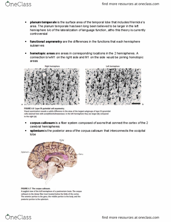 PSYB55H3 Chapter Notes - Chapter 4.2: Occipital Lobe, Temporal Lobe thumbnail