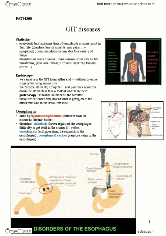 PATH 300 Lecture Notes - Lecture 7: Esophageal Varices, Varicose Veins, Achalasia thumbnail