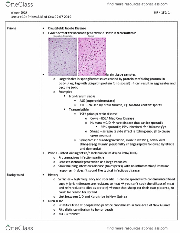 BIPN 150 Lecture Notes - Lecture 10: Bovine Spongiform Encephalopathy, Neurodegeneration, Scrapie thumbnail