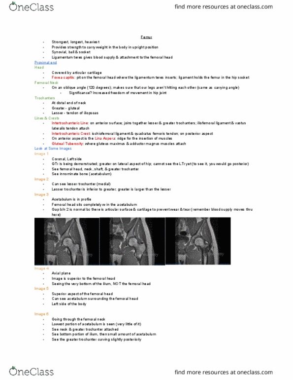 MEDRADSC 2D03 Lecture Notes - Lecture 6: Lesser Trochanter, Femur Neck, Ischiofemoral Ligament thumbnail