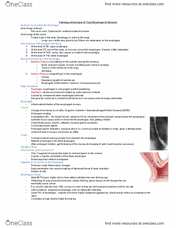 MEDRADSC 2I03 Lecture Notes - Lecture 4: Hiatus Hernia, Esophageal Cancer, Aortic Aneurysm thumbnail