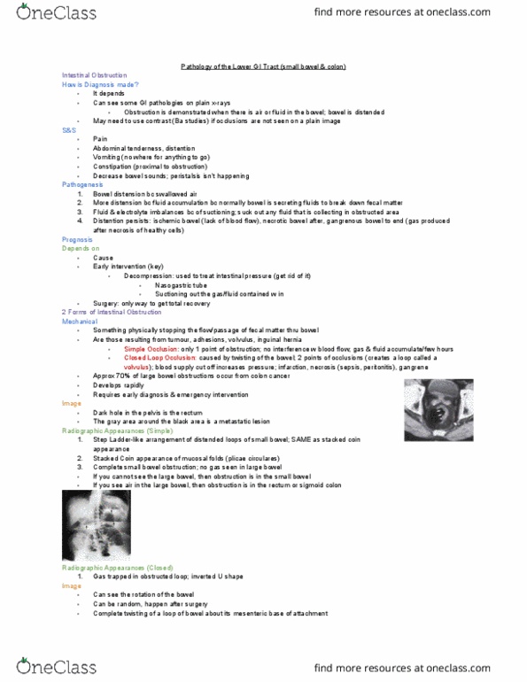 MEDRADSC 2I03 Lecture Notes - Lecture 7: Bowel Obstruction, Inguinal Hernia, Glycemic Index thumbnail