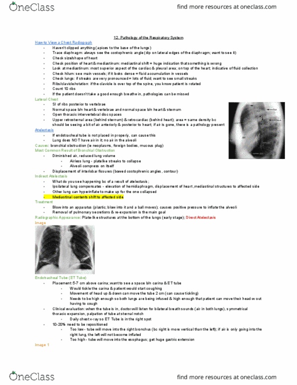 MEDRADSC 2I03 Lecture Notes - Lecture 12: Costodiaphragmatic Recess, Airway Obstruction, Chest Tube thumbnail