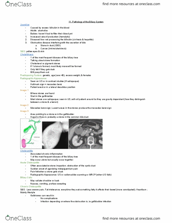 MEDRADSC 2I03 Lecture Notes - Lecture 11: Biliary Tract, Common Bile Duct, Cystic Duct thumbnail