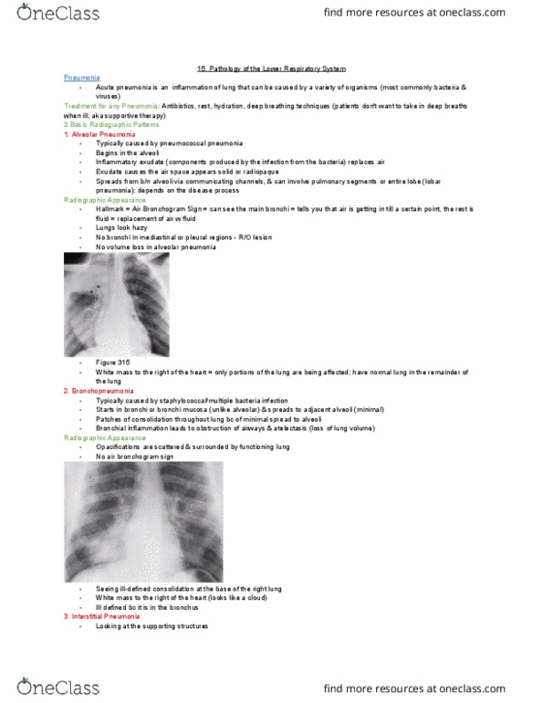 MEDRADSC 2I03 Lecture Notes - Lecture 15: Lobar Pneumonia, Airway Obstruction, Radiodensity thumbnail