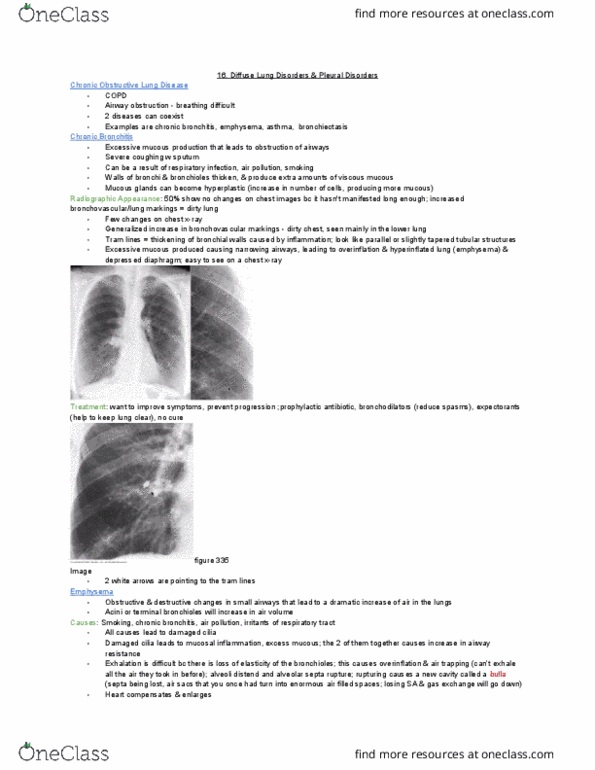 MEDRADSC 2I03 Lecture Notes - Lecture 16: Airway Obstruction, Hyperplasia, Bronchitis thumbnail