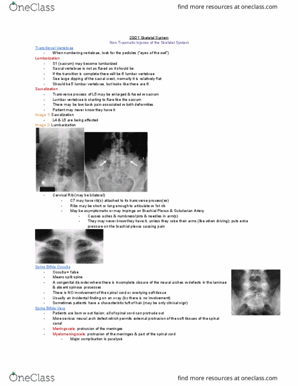 MEDRADSC 2I03 Lecture Notes - Lecture 20: Brachial Plexus, Lumbar Vertebrae, Vertebra thumbnail