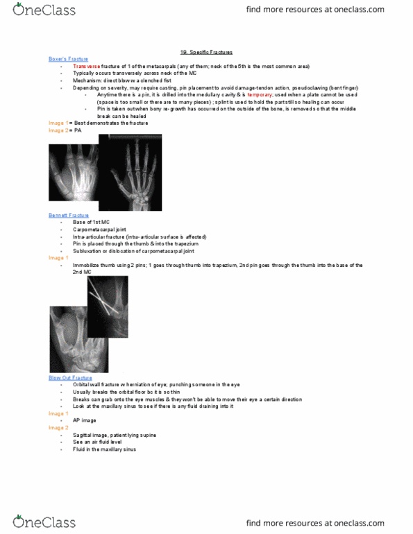 MEDRADSC 2I03 Lecture Notes - Lecture 19: Maxillary Sinus, Carpometacarpal Joint, Medullary Cavity thumbnail