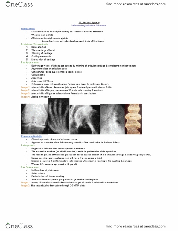 MEDRADSC 2I03 Lecture Notes - Lecture 22: Hyaline Cartilage, Rheumatoid Arthritis, Inflammatory Arthritis thumbnail
