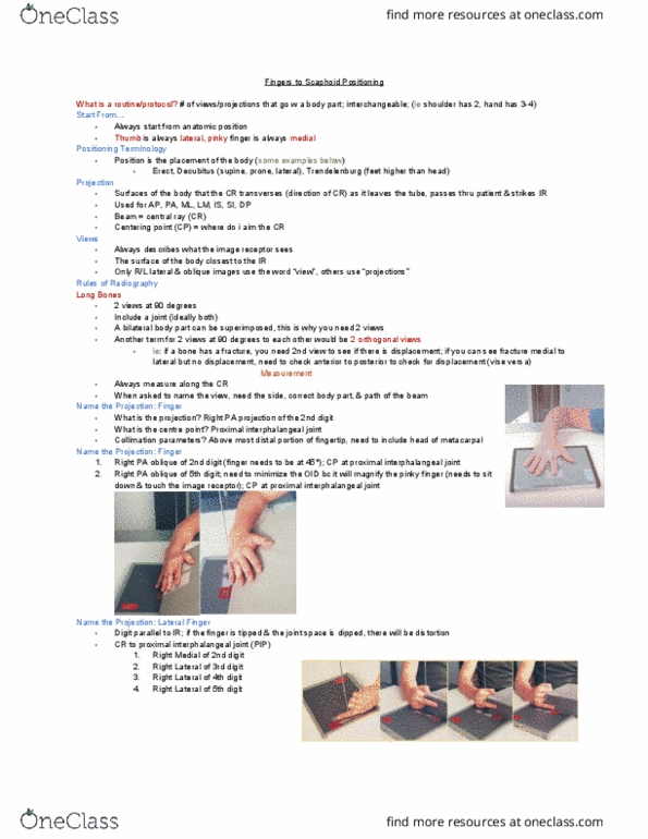 MEDRADSC 2G03 Lecture Notes - Lecture 2: Scaphoid Fracture, Oblique Projection, Scaphoid Bone thumbnail
