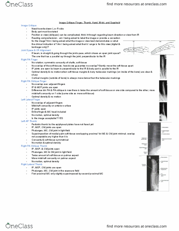 MEDRADSC 2G03 Lecture Notes - Lecture 1: Phalanx Bone, Soft Tissue, Scaphoid Bone thumbnail