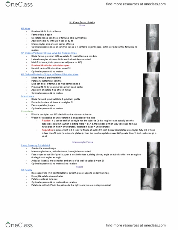 MEDRADSC 2G03 Lecture Notes - Lecture 3: Intercondylar Area, Lower Extremity Of Femur, Adductor Tubercle Of Femur thumbnail