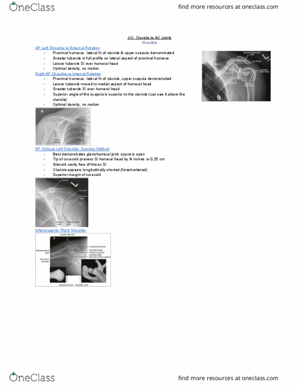 MEDRADSC 2G03 Lecture Notes - Lecture 5: Lesser Tubercle, Upper Extremity Of Humerus, Shoulder Joint thumbnail