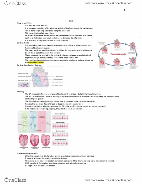 MEDRADSC 2A03 Lecture Notes - Lecture 13: Purkinje Fibers, Sinus Rhythm, Qrs Complex thumbnail