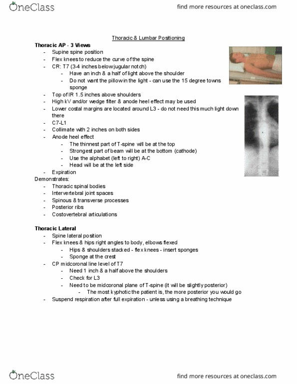 MEDRADSC 2H03 Lecture Notes - Lecture 5: Suprasternal Notch, Kyphosis, Supine Position thumbnail