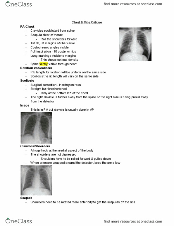 MEDRADSC 2H03 Lecture Notes - Lecture 2: Harrington Rod, Scoliosis, Clavicle thumbnail