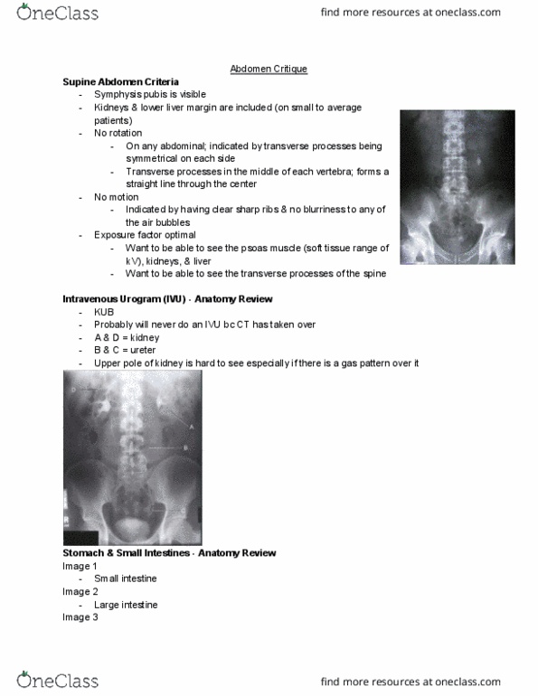 MEDRADSC 2H03 Lecture Notes - Lecture 3: Abdominal X-Ray, Vertebra, Small Intestine thumbnail