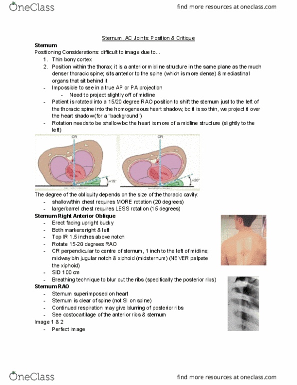 MEDRADSC 2H03 Lecture Notes - Lecture 4: Suprasternal Notch, Thoracic Vertebrae, Thoracic Cavity thumbnail
