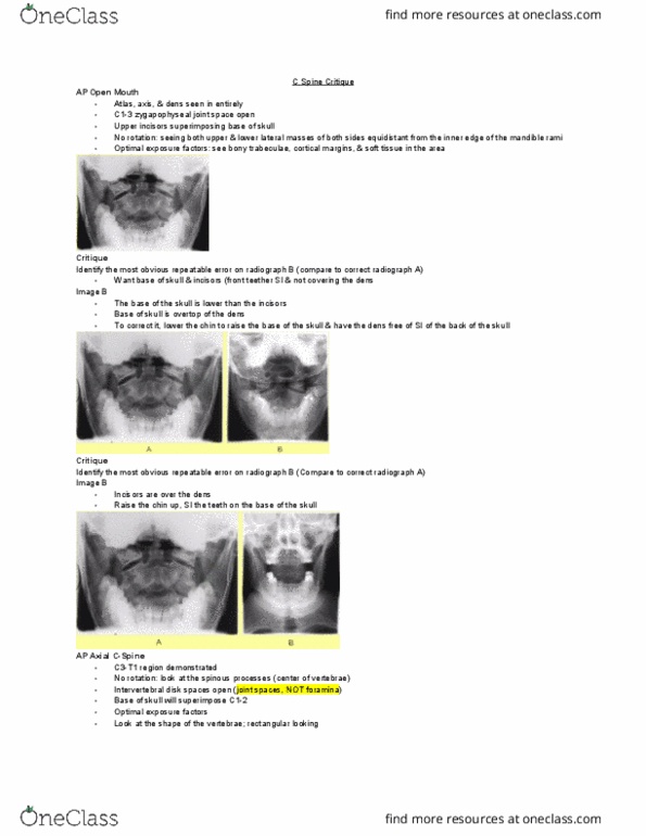 MEDRADSC 2H03 Lecture Notes - Lecture 6: Facet Joint, Intervertebral Foramina, Radiography thumbnail