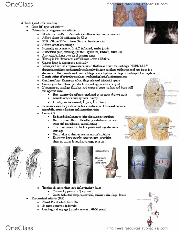 BIOL355 Lecture Notes - Lecture 31: Hyaline Cartilage, Rheumatoid Arthritis, Lumbar Vertebrae thumbnail