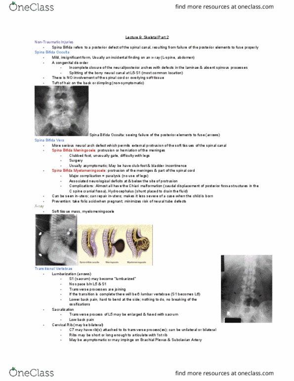 MEDRADSC 3J03 Lecture Notes - Lecture 9: Arnold–Chiari Malformation, Neural Tube Defect, Spinal Canal thumbnail
